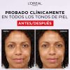 Revitalift Filler Gel Creme de enchimento com ácido hialurónico thumbnail