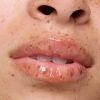 The Super Peptide Tratamento Labial thumbnail