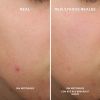 Bye Bye Breakout Serum thumbnail