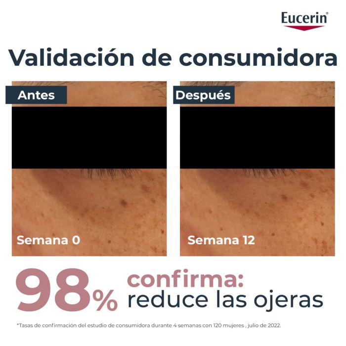 Anti-Pigment Contorno de Ojos