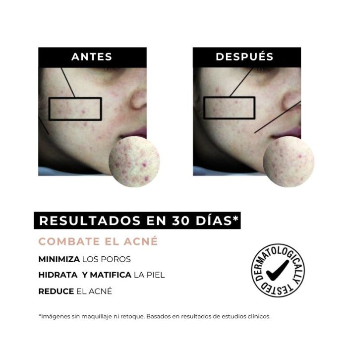 Equilibrium Crema Antiacne