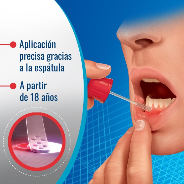 Filmogel Aphte et petites plaies buccales
