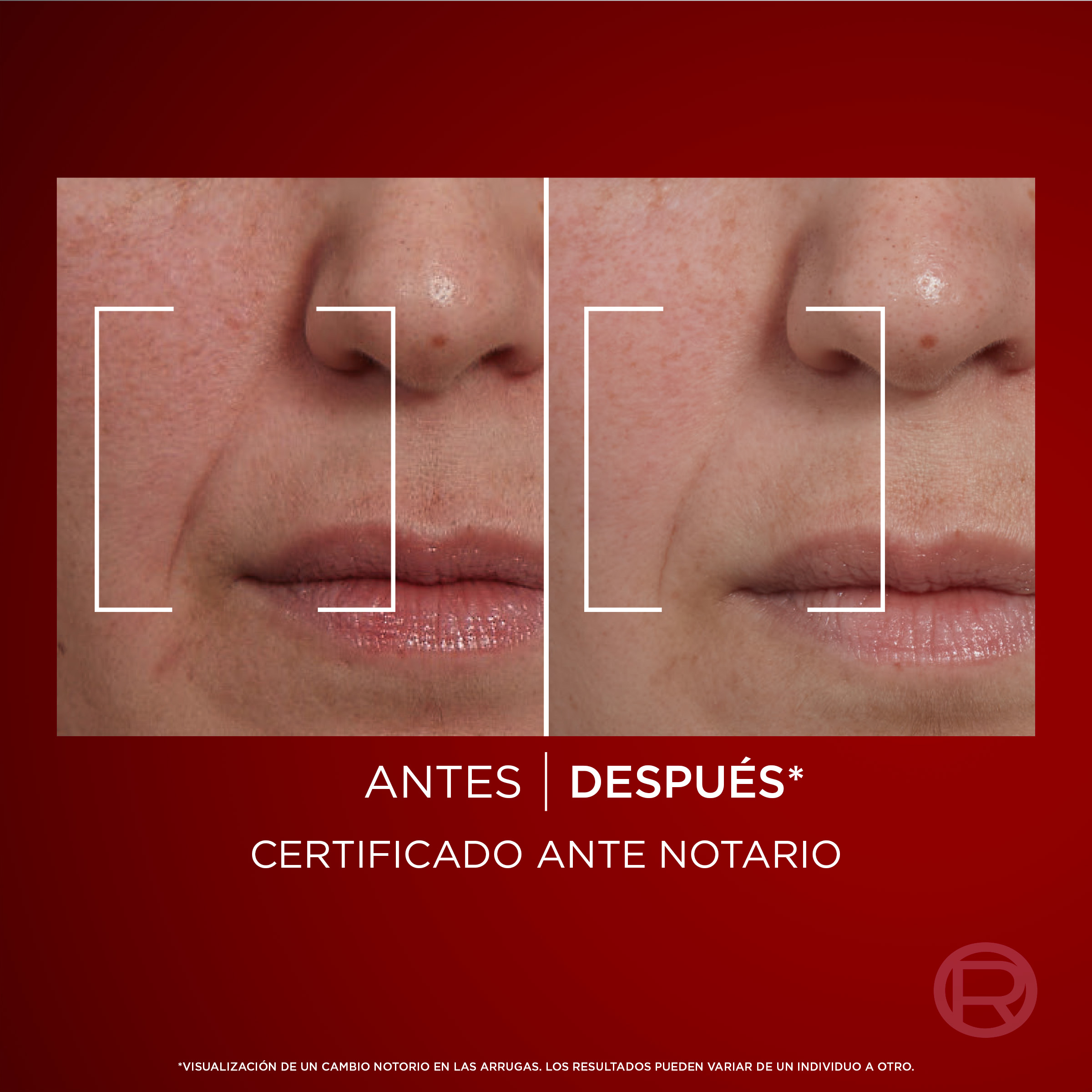 Revitalift Laser Crema de día · detalle 5