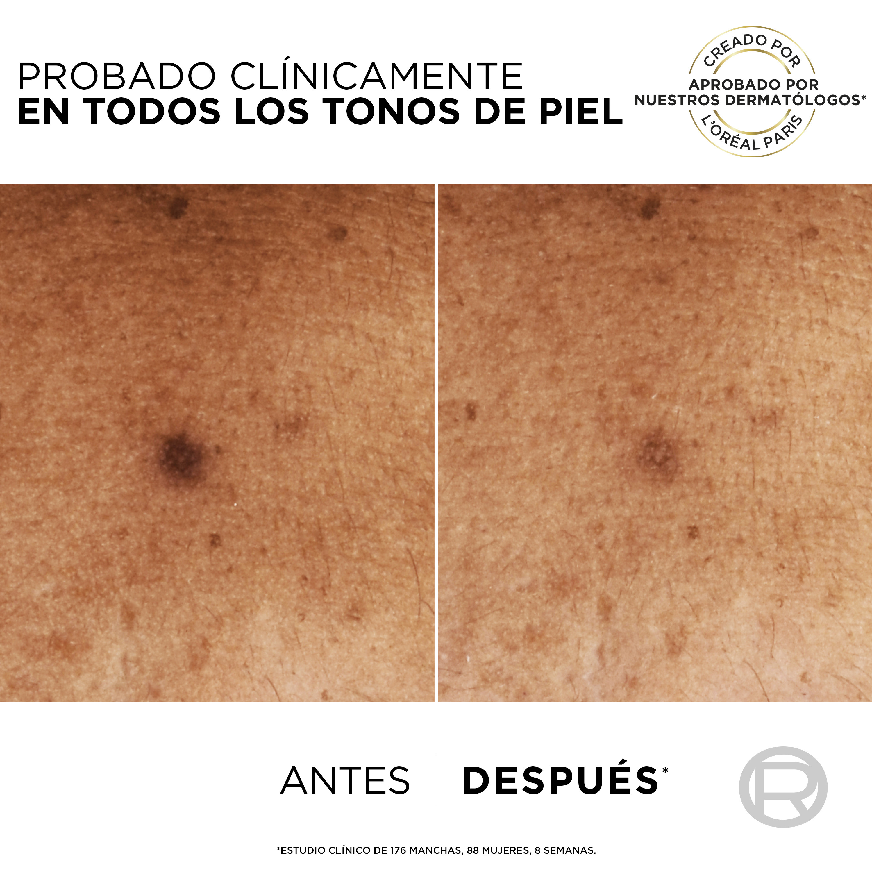 Bright Reveal Sérum con Niacinamida Anti Manchas · detalle 4