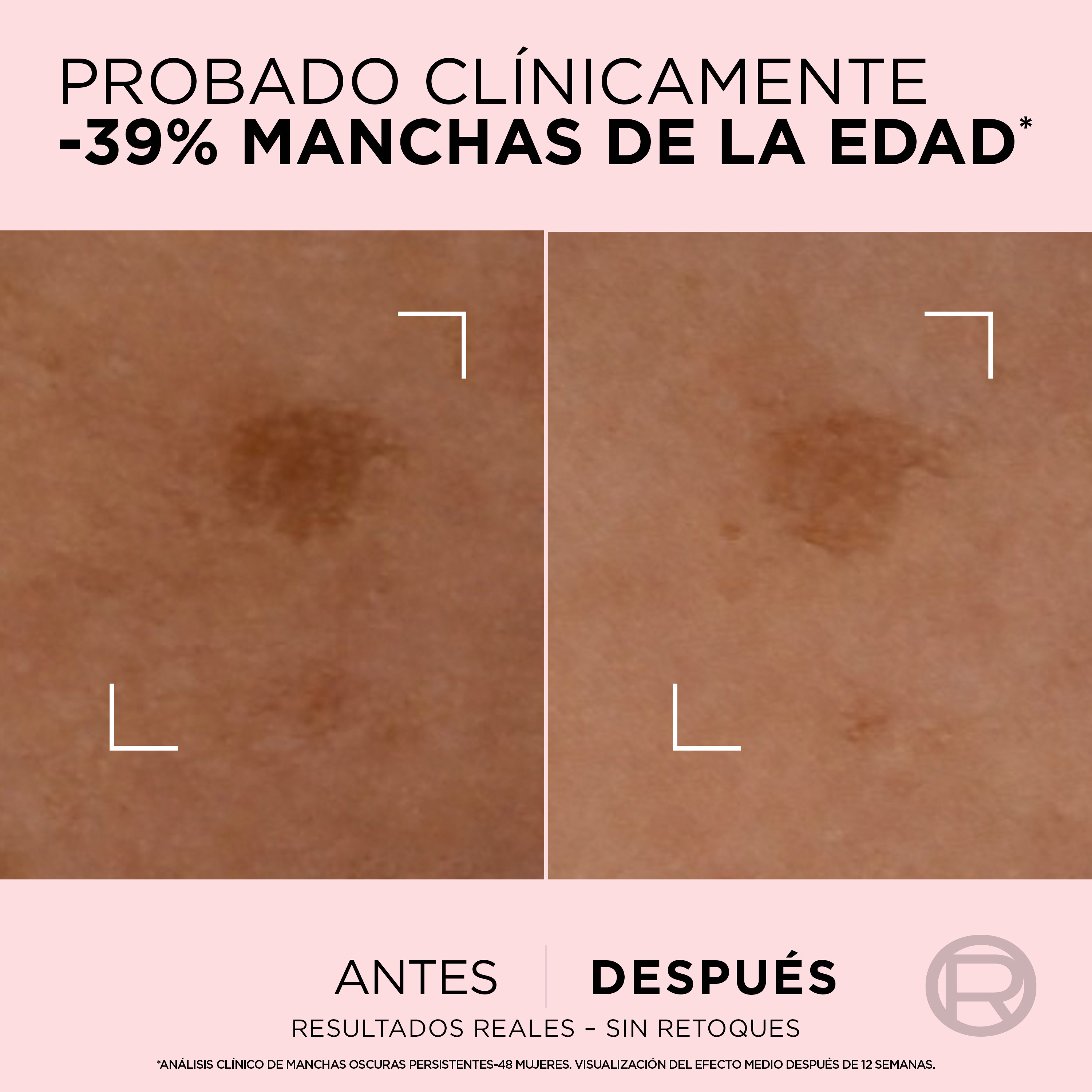 Age Perfect Serum Corrector Acción Rápida Anti-Manchas para Pieles Maduras · detalle 5
