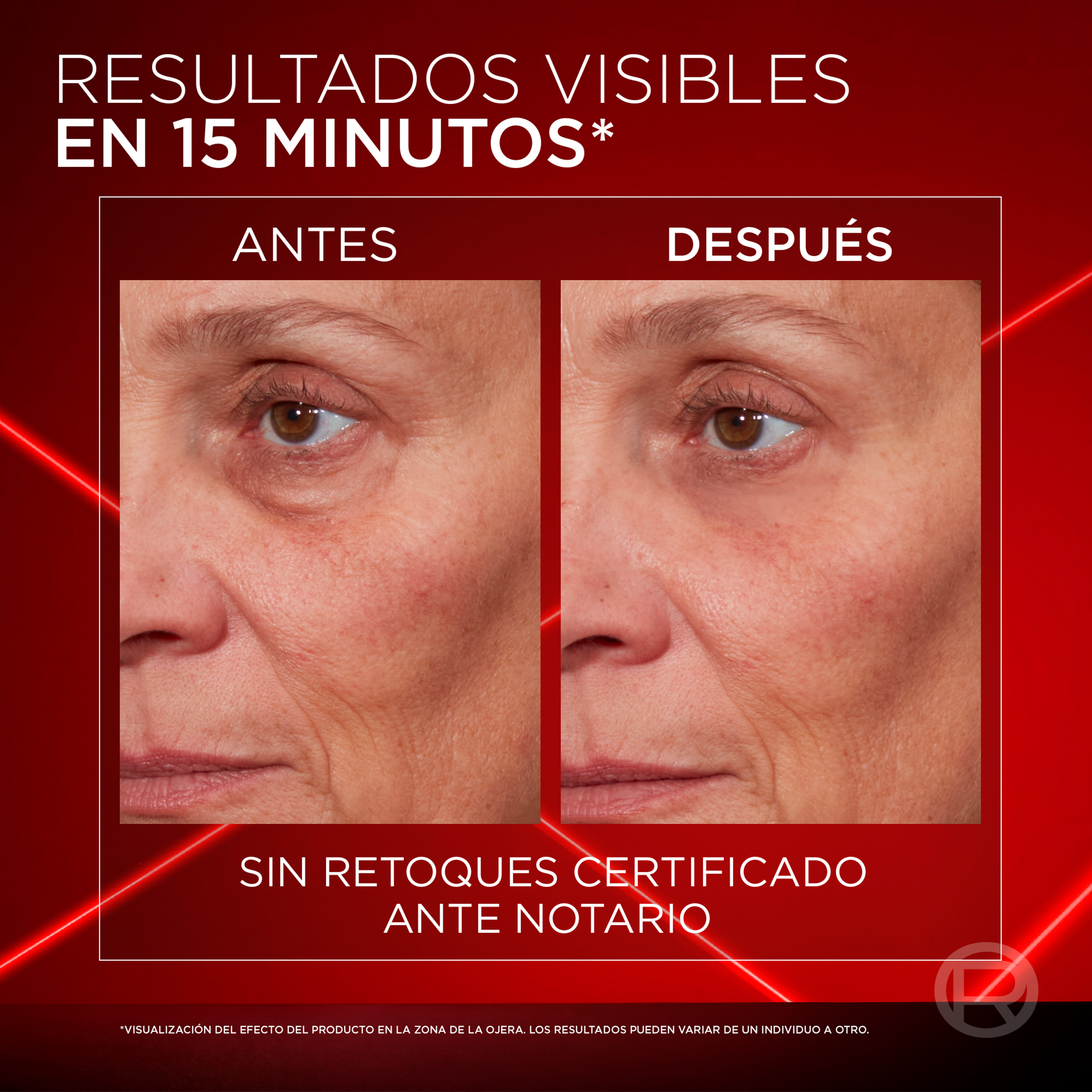 Revitalift Laser Borrador de Bolsas Instantáneo · detalle 2