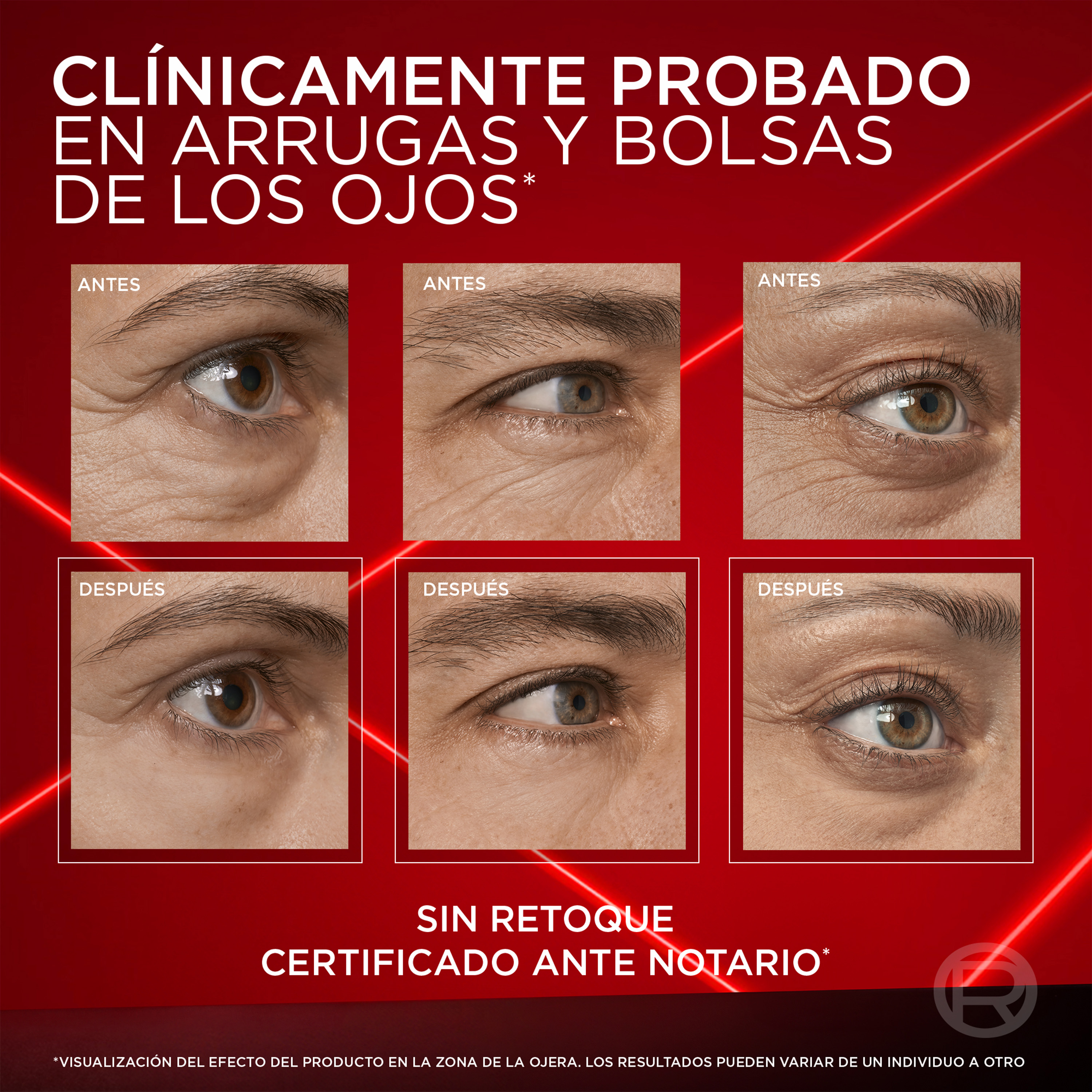 Revitalift Laser Borrador de Bolsas Instantáneo · detalle 5