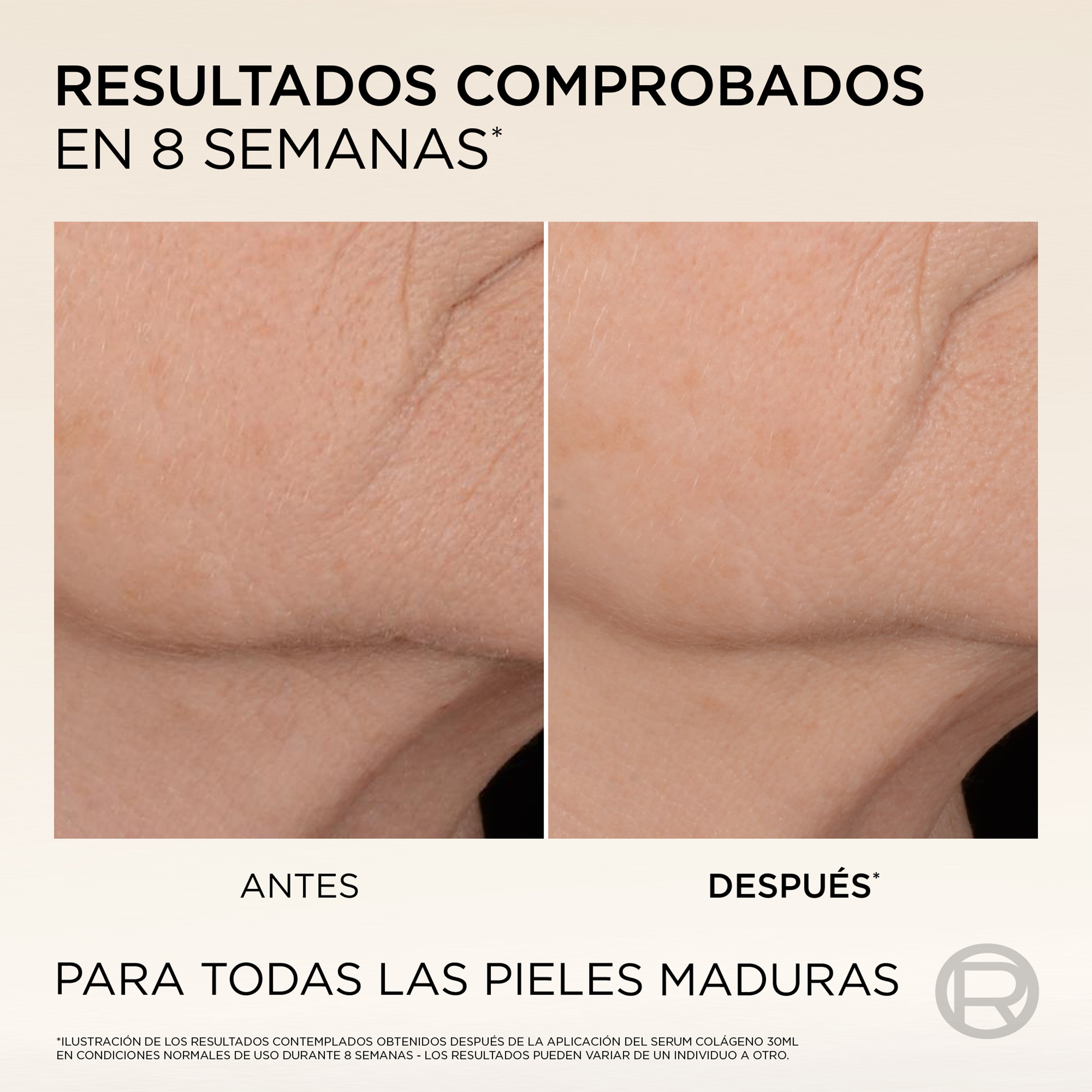 Age Perfect Micro-Colágeno Péptido Serum Anti-Flacidez · detalle 5